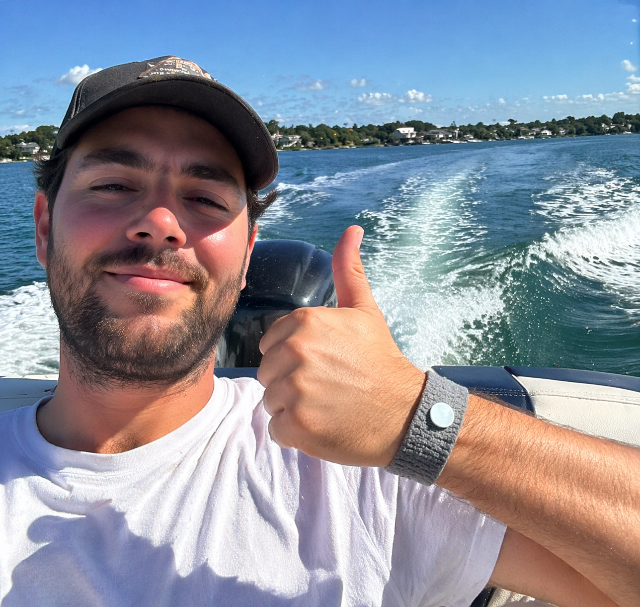 Arvento™ Nausea Relief Band